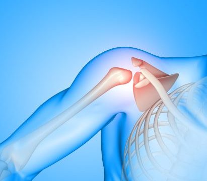 Orthopedic Surgery